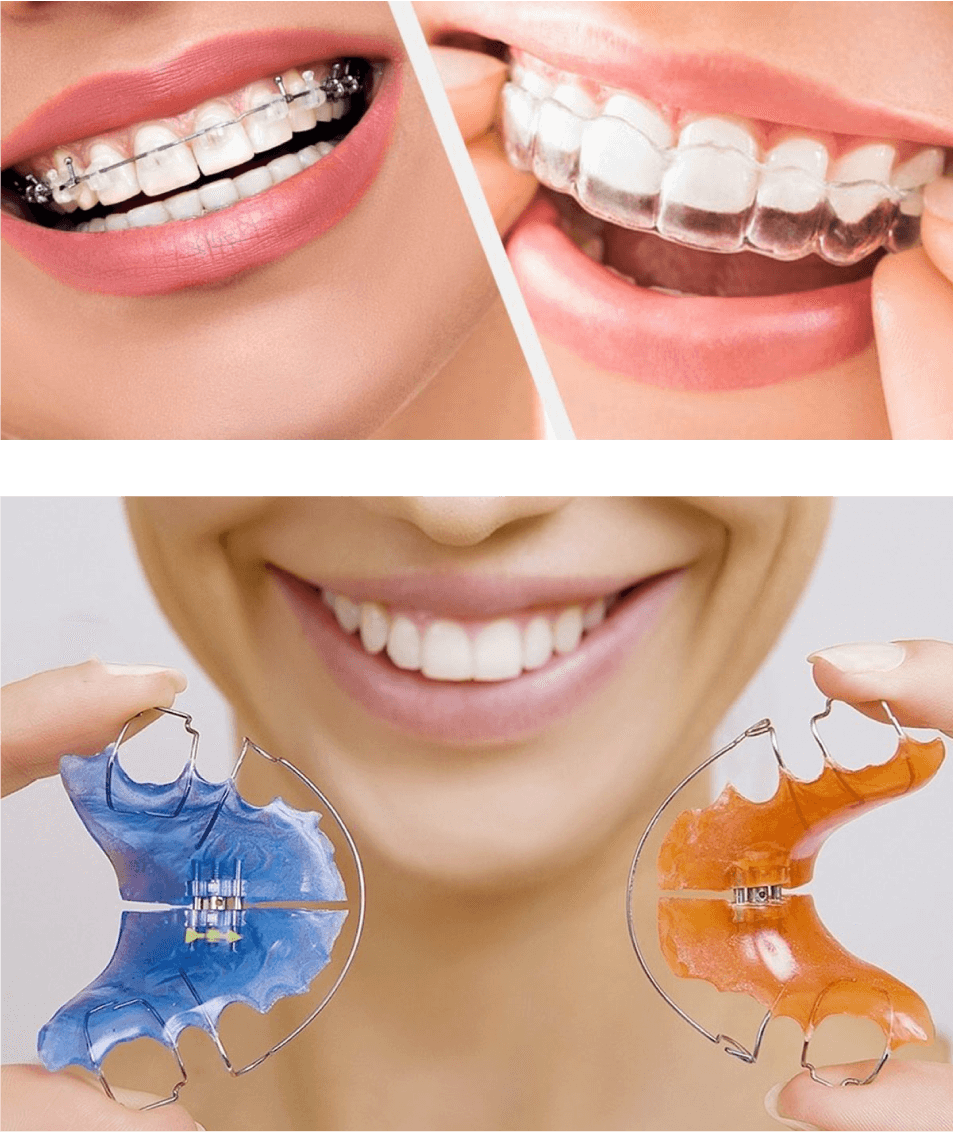 dr. Hermann Boglárka fogszabályozás