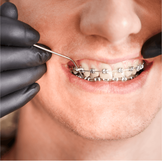 dr. Hermann Boglárka fogszabályozás