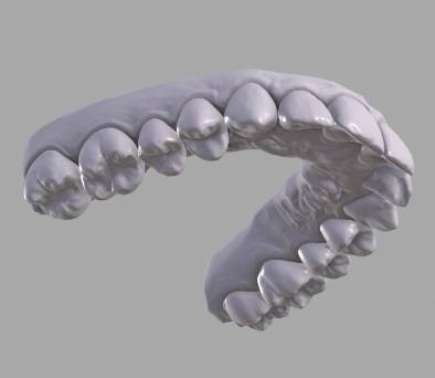 dr. Hermann Boglárka fogszabályozás