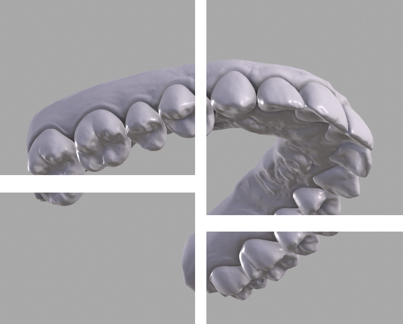 dr. Hermann Boglárka fogszabályozás