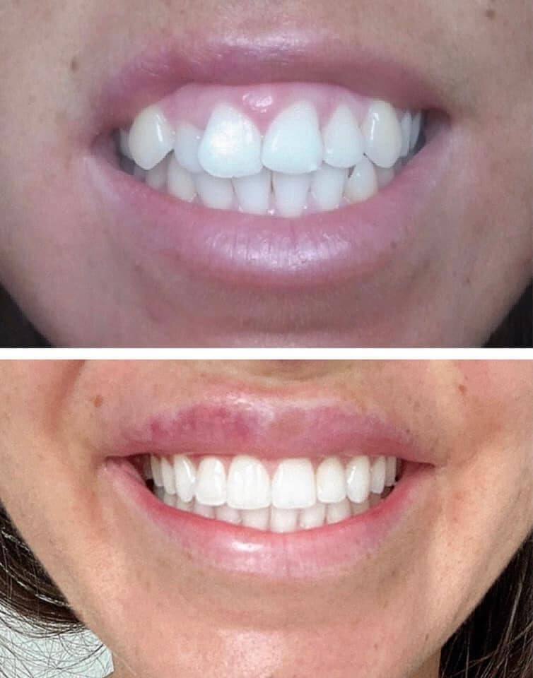 dr. Hermann Boglárka fogszabályozás