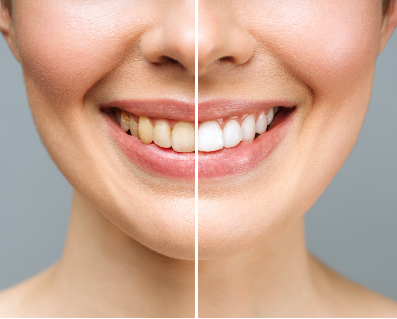 dr. Hermann Boglárka fogszabályozás