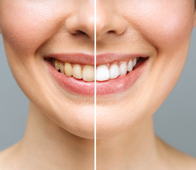 dr. Hermann Boglárka fogszabályozás