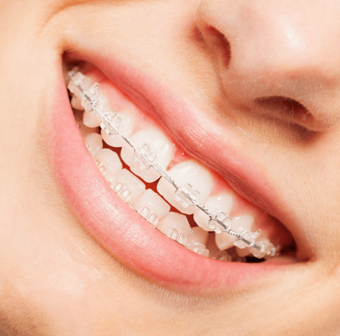 dr. Hermann Boglárka fogszabályozás