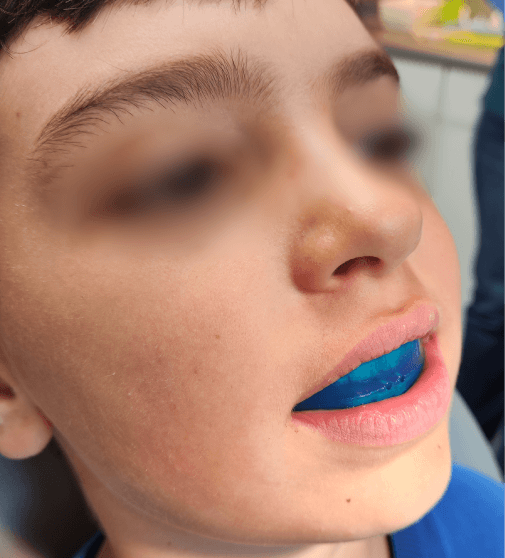 dr. Hermann Boglárka fogszabályozás