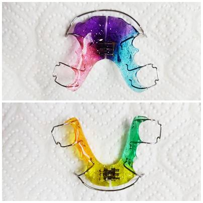 dr. Hermann Boglárka fogszabályozás