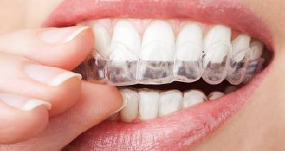 dr. Hermann Boglárka fogszabályozás